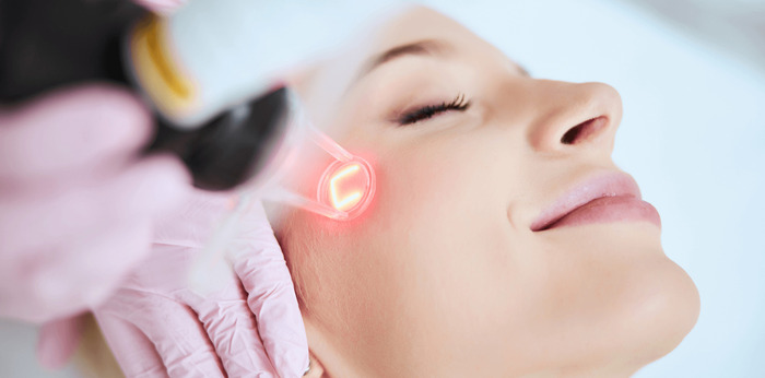 Trẻ hóa da mặt bằng phương pháp laser